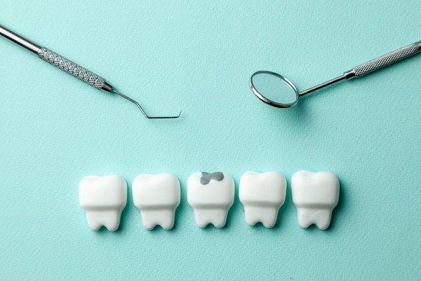 正常な歯と虫歯の模型