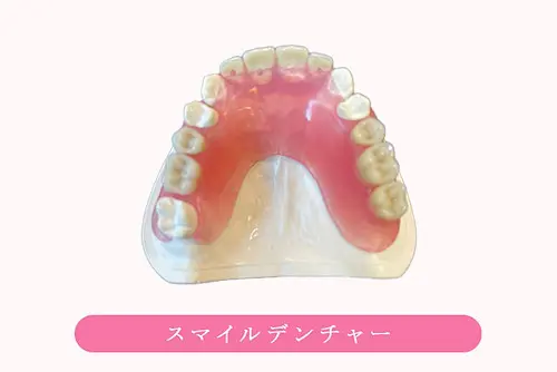 義歯・入れ歯 - 柏市にある柏などがや歯科クリニック