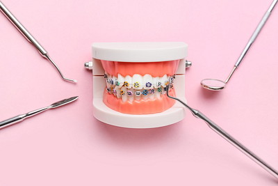 矯正器具を装着した歯の模型
