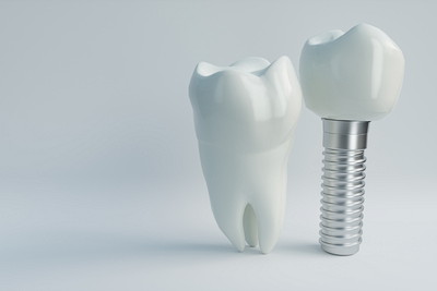 通常の歯とインプラントの歯の模型
