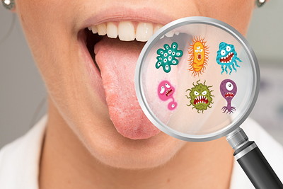 口腔内の細菌のイメージ