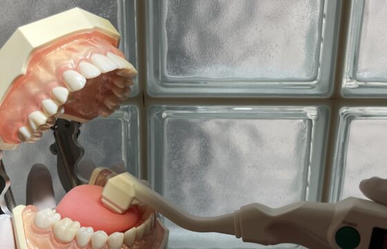 口腔乾燥 画像
